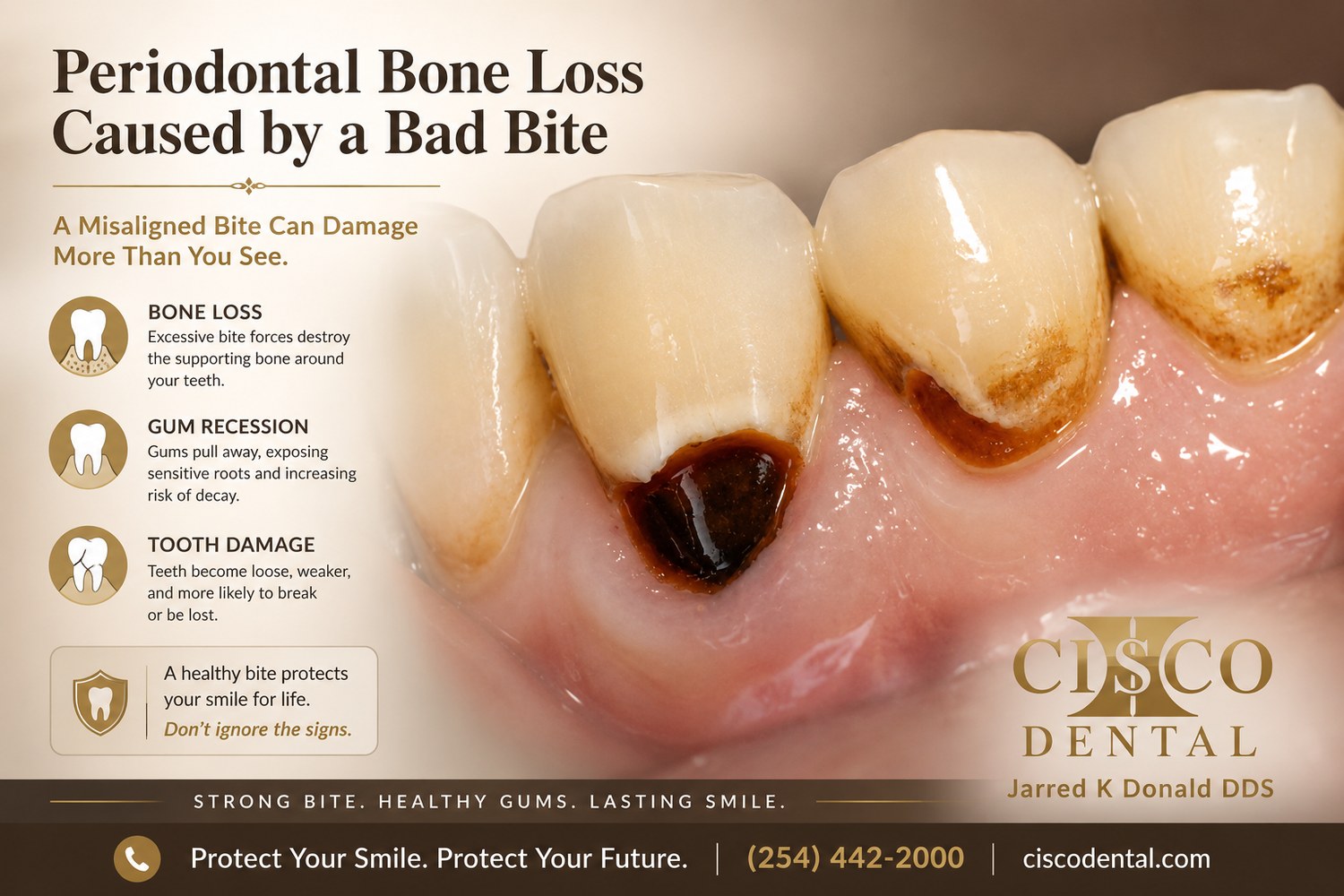 Educational graphic: periodontal bone loss and cervical decay aggravated by an unhealthy bite, with a clinical photo