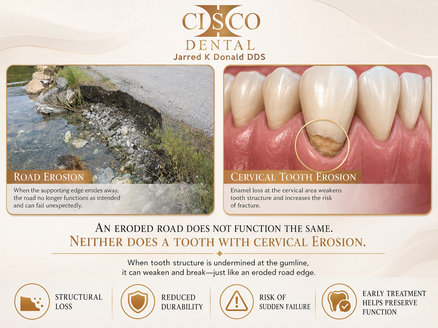 Analogy comparing an eroded road edge with cervical tooth erosion: both are undermined at the base and prone to sudden failure